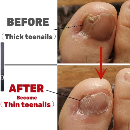 IDOU Zehennagelfeilen für dicke Nägel, Edelstahl, 4 Seiten, 17,8 cm Länge, Nagelfeilen für Männer, Senioren und Hunde