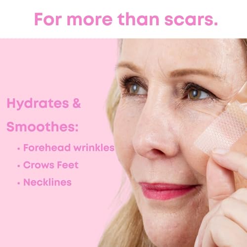 Image of Advanced Silicone Scar Sheets for Women, Medical grade silicone scar tape, Customized for Moms, Extra Long 1.6 inch x 60 inch, New Easy-Use Tear-Lines, Surgical Scars, C-Section, Tummy Tuck, Face Wrinkles