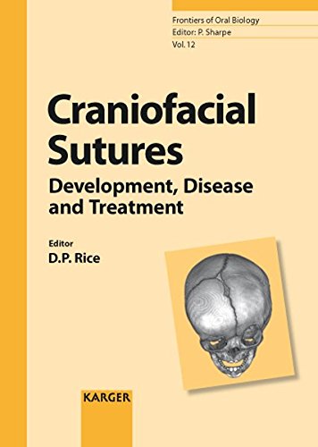 Craniofacial Sutures: Development, Disease and Treatment (Frontiers of Oral Biology, Vol. 12)