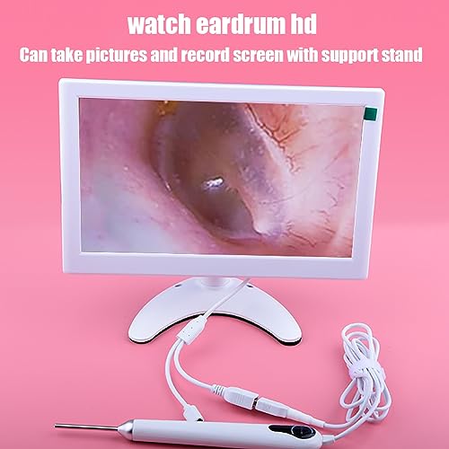 Cámara otoscopio digital para eliminar la cera del oído con pantalla 5