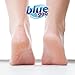 Blue Goo CRACKED HEELS & DRY HANDS Skin Softener for Dry Feet, Hands, Hydrating and Smoothing, Moisturizer, Dryness Relief, 2 Ounce, made with 100% PURE EMU OIL