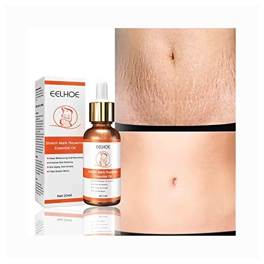 20ML Stretch Mark Repairing Essential Oil Scar Removal Cream Serum Improve Stubborn Lines Wrinkles Firming Lifting Loose Repair Moisturized Treatment Cream for Pregnant Woman Youthful Skin