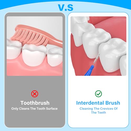 Luthando 100 Stück Zahnzwischenraumbürsten, Interdentalbürsten Zahnstocher, Interdentalbürste Zahnseide Wiederverwendbar Dentalbürsten Zahnreinigung Werkzeug(Rot und Blau) – Bild 7