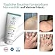 ectocare® Basispflege Creme mit 3,5% Ectoin 200ml | Bei Dermatitis, Neurodermitis & Schuppenflechte | Lindert trockene, gereizte und juckende Haut ohne Kortison | Medizinprodukt für Kinder und Babys