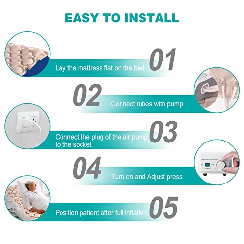 Hithinkmed Alternating Air Pressure Mattress, Pressure Pads For Bed Sores, Includes Mattress Pad And Ultra Quiet Electric Pump System, Ulcer Bed Sore Prevention Mattress For Hospital And Home Use #TOP6