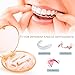 Retainer Case Fashion Style, Cute Mouth Guard Case with Magnetic Closure Hinged Lid, Daily Aligner Cases Easy to Carry, Denture Cases Aligner Container Slim for Office/School/Traveling