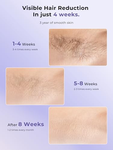 Image of Ubroo Laser Hair Removal with 5℃ Ice Cooling,Hand-held Hair Removal Device IPL Hair Removal for Women and Men,Reduce Hair Regrowth,Full Body Use for Legs,Bikini,Armpits(Purple)