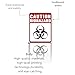 Biohazard Stickers Sign，Self-Adhesive Waterproof Durable Biohazard Warning Hazard Labels, Toxic Waste Sticker for Labs Hospitals and Industrial Use Universal Biohazard Symbol 5.1
