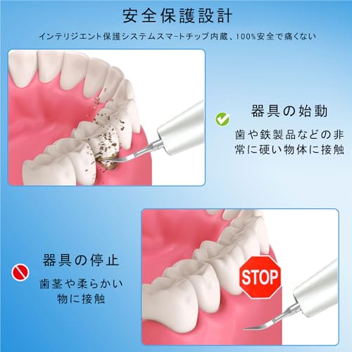 vimaydo 超音波歯クリーナー 口腔洗浄器 USB 充電式 家庭用携帯用歯清潔器 の商品画像 3