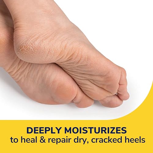 Dr. Scholl's Bálsamo reparador de calcanhar rachado 70 g, com 25% de ureia para pés secos rachados,