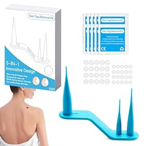 Wxshuoyu Stielwarzen Entferner Set 40 Stück