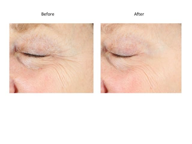 Miniatura 6 de Bluelene EyePlus+, una nueva fórmula impulsada por la trifecta definitiva de azul de metileno, ergotioneína y niacinamida. Aprobado por