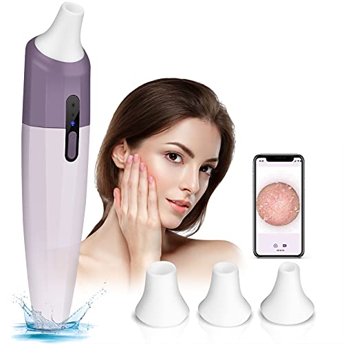 Blackhead Remover Vacuum, Pore Vacuum with Camera, WiFi Visible Facial Pore Cleaner, 1080P HD Wireless Black Head Remover, USB Rechargeable Blackhead Vacuum with 3 Probes, Pore Extractor for All Skin