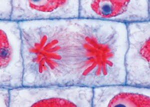 3B Scientific GmbH W13436 General Biology 25 Slides School Set A, Grade: 1 to 2