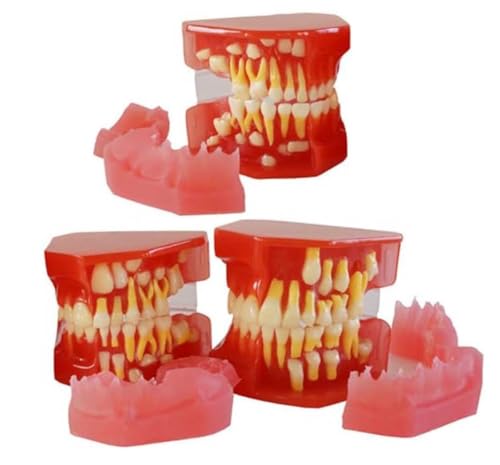 Modèles de progrès de remplacement de dents pour la communication claire