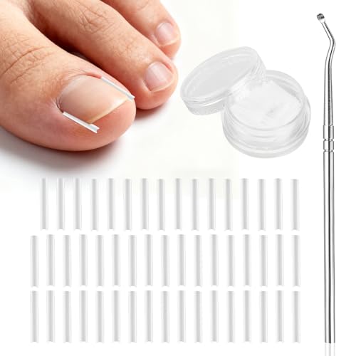 (50+1) Pcs Ingrown Toenail Treatment Corrector Set, Professional Pain-Free Ingrowns Toenails Removal Kit with Lifter, Toenail Strip for Men Women, Easy Fixed Ingrowns Toenails Tool