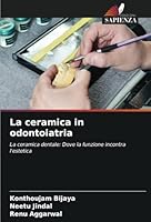 La ceramica in odontoiatria: La ceramica dentale: Dove la funzione incontra l'estetica (Italian Edition) 3330840722 Book Cover