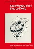 Tumor Surgery of the Head and Neck 3805520921 Book Cover