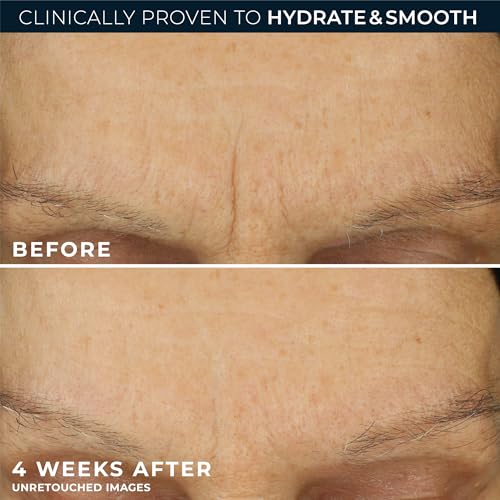 RoC Retinol Correxion Max Hydration Moisturizer