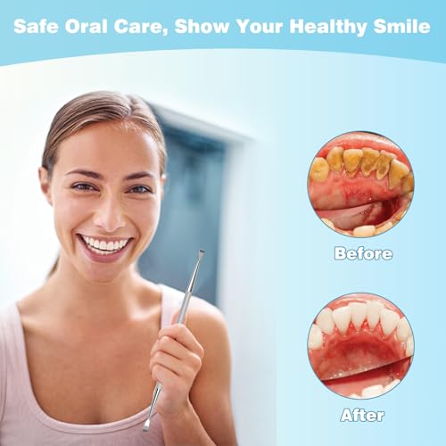 Image of Dental Tools, Dental Pick Stainless Steel Teeth Cleaning Tools with Case
