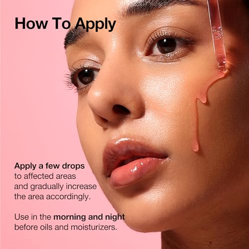 Image of Anua Niacinamide 10 + TXA 4 Serum, Dark Spot Care, Hyaluronic Acid, Tranexamic Acid, Lightweight & Hydrating All-in-One Daily Facial Serum for Glass Skin, Korean Skincare, 1.01 fl.oz /30ml