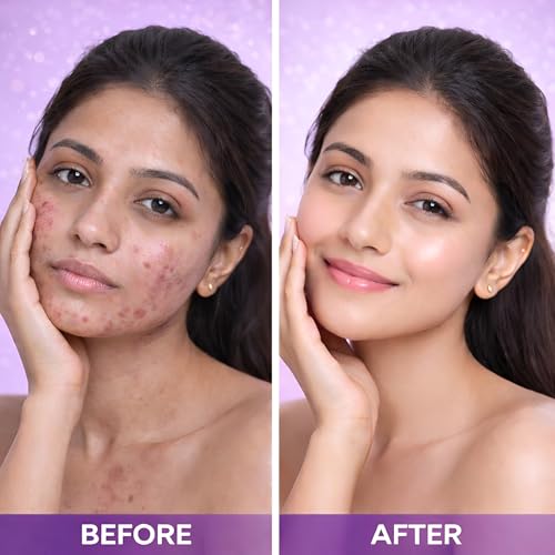 Image of Glycolic Acid 6% & Kojic Acid 2% Face Serum | Brightening & Even Skin Tone Serum | Helps Reduce Appearance of Dark Spots, Pigmentation & Dull Skin | 30 ml