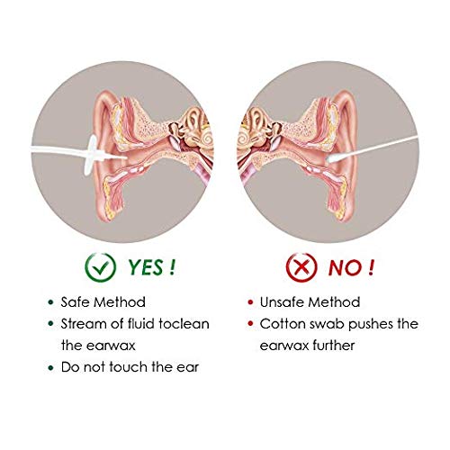 Ear Wax Removal Tool for Ear Irrigation, Ear Wax Removal Kit for Ear Cleaning, Earwax Remover for Adults and Kids, Including 1 Ear Washer Bottle, 5 Disposable Tips, 1 Thread Cap and 1 Bulb Syringe. - Thumbnail 6