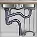 Oedema Undermount Sink Brackets Stainless Steel Under Sink Support Brackets Adjustable Sink Support Leg 15.8