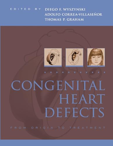 How do you say congenital