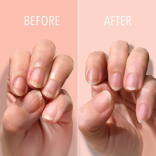 Londontown LNT-008 Kur Nail Ridge Filler - Smoother - Strengthener thumb #1