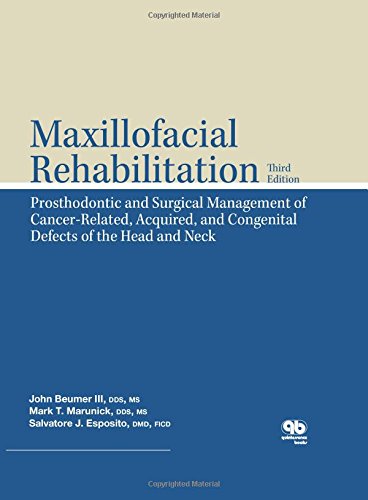 Maxillofacial Rehabilitation: Prosthodontic and Surgical Management of Cancer-Related, Acquired, and