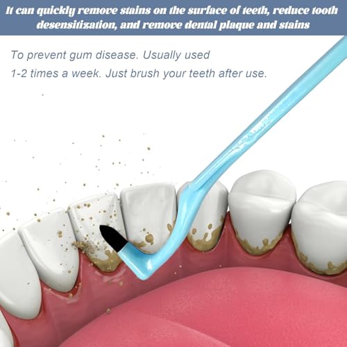 8 Stück Zahnsteinentferner,zahnstein entfernen, Zahnstein Selbst Entfernen, Zahnpolierer, Zahnbürste Teeth Stain Remover, Zahnbelag Entferner für Entfernt Verfärbungen, Plaque & Zahnstein