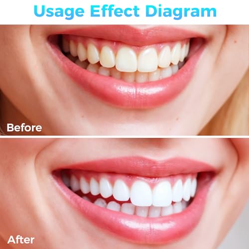 Image of 100 Pcs Interdental Brushes, 4 Sizes Braces Flossers for Cleaner | Braces Brush Soft Dental Brushe Toothpicks Dental Floss Picks Dental for Brace Oral Cleaning(5 Colors)