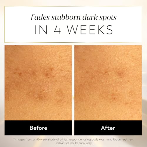 Image of Olay Dark Spot Correcting Body Lotion for Women, 24HR Moisture, Fast-Absorbing Care, with Vitamin B3, AHA, & Vitamin C, Free of Parabens & Phthalates, Vibrant Citrus & Soft Florals Scent, 17 fl oz