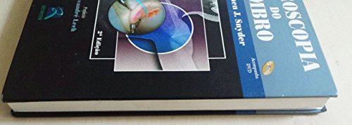 Artroscopia do Ombro