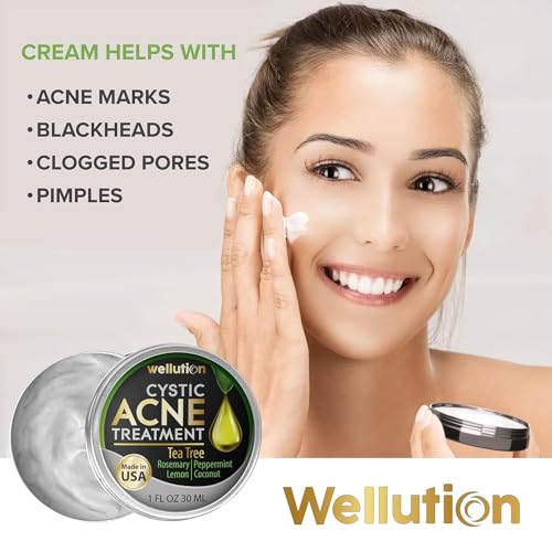 Cystic-Acne-Treatment-Cream-Natural-Pimple-and-Scar-Remover-with-Tea-Tree-Oil-Effective-Overnight-Face-Treatment-for-Acne-Spots-Pimples-and-Scars-1oz