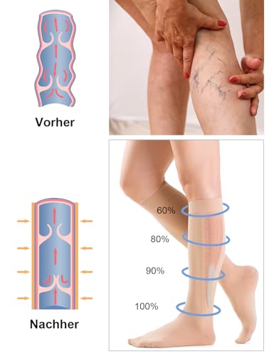Medizinische Kompressionsstrümpfe Damen & Herren 20-30 mmHg, Klasse 2, Stützstrümpfe Thrombosestrümpfe (Compression Socks) Für Krampfadern & Reise Ödeme Flug(Beige, L)