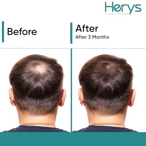 Image of Herys Rosemary Hair Growth Serum | 3% Redensyl & Anagain | Hair fall control serum for Women & Men | Promotes Hair Growth & Stimulates Hair Follicles | For All Hair Types | 30ml