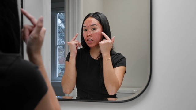 Image of The Ordinary AHA 30% + BHA 2% Peeling Solution, Advanced Exfoliating Peel for Brighter Skin