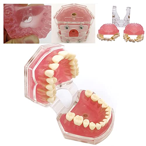 All Removable Teeth Model Dental Demonstration Teeth Model Silica Gel Material Soft and Bendable Tooth Model