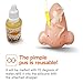 KYW Pimple Popping Toy, Pimple Popper Toy Funny Nose Stress Relief Pimple Popping Toy for Adults Kids