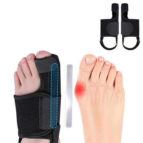 Recovist Bunion Brace for Women & Men Bunion Corrector | Bunion splint Big Toe Straightener. alleviation Pain & Corrects Toe Alignment. For Left & Right Foot (1 Pair)