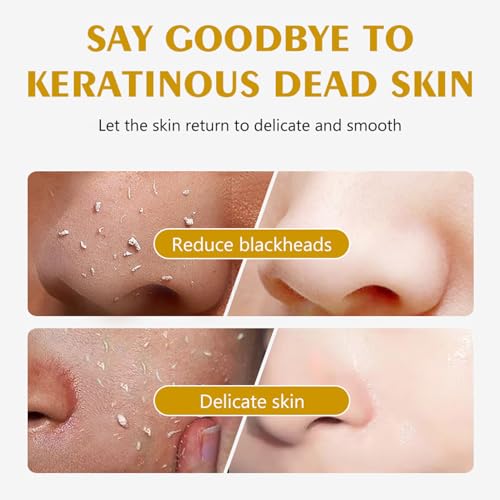 Lemon Exfoliating Gel,Lemon Peeling Gel,Vitamin C Face Scrub,Soft your Skin & Remove Dead Skin,Natural Face Scrub Exfoliator for Blackhead,Mild Face Exfoliator Scrub for Radiant Skin,Face & Body &Knee - Image 3