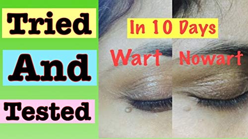 Wartosin Wart Remover Pack, Green, 3 ml