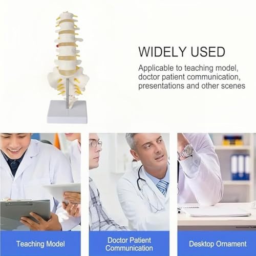Image of Human Anatomical Lumbar Disc Herniation Model Life Size Lumbar Spine Model for Teaching and Learning (Spine-Tall)
