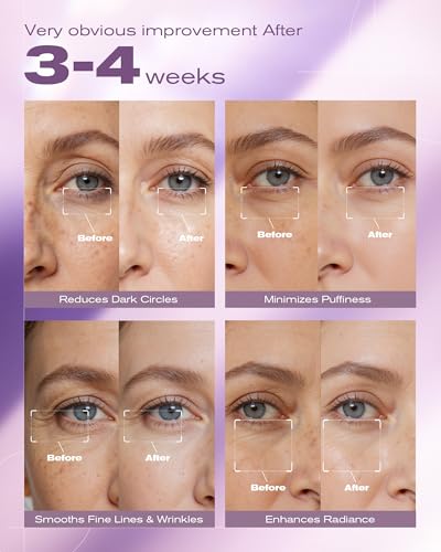8% Caffeine Eye Cream & Retinol Under Eye Cream to Reduce Dark Circles, Puffiness, Wrinkles and Fine Lines, Anti Aging Under Eyes Serum, 1.01 FL.OZ image 3