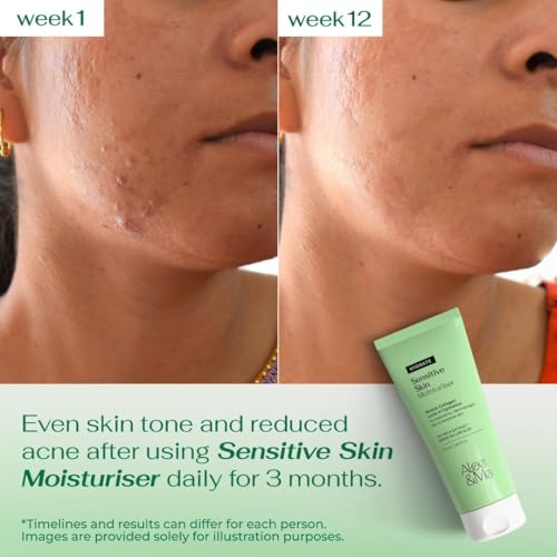 Image of Aloe&Me Creme Gel Face and Body Moisturizer For Oily & Acne Prone Skin | Oil-free | Fast Absorbing | Non sticky | Fragrance Free | 50 ml