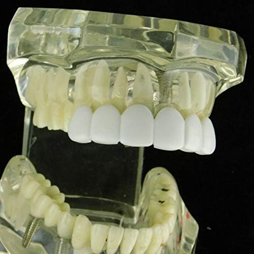 Grillz Plástico Removible Para Seis Dientes Superiores miniatura 2