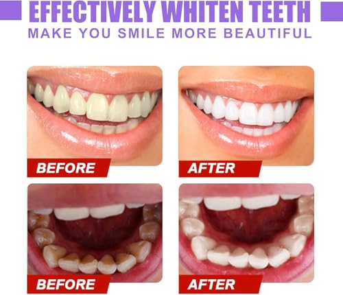 Purple Teeth Whitening Toothpaste, Whitening Zahnpasta, Zahnfleckenentfernung, Lila Zahnpasta für Zahnaufhellung,Eine Schonende Pflege Des Zahnfleisches (1, Original)