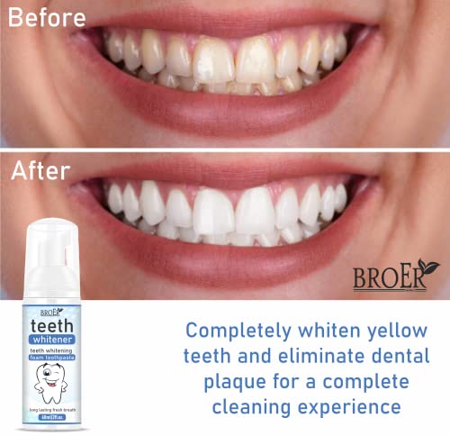 Image of BROER Naturals Teeth Whitener | Teeth Whitening Foam To Remove Yellow Stains, Tobacoo, Tartar and Tobacco Stains - 60ml